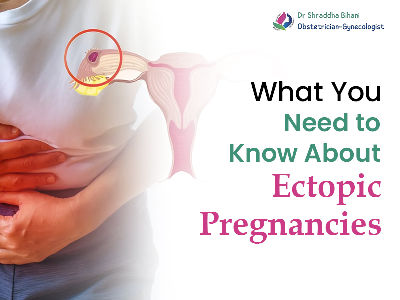 Woman holding her abdomen in pain with a medical illustration of an ectopic pregnancy, alongside the text “What You Need to Know About Ectopic Pregnancies” by Dr. Shraddha Bihani, Obstetrician-Gynecologist.