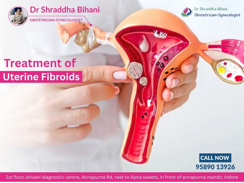 Uterine Fibroid Treatment in Indore by Dr. Shraddha Bihani, expert obstetrician-gynecologist providing advanced care for women’s health.